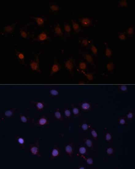 Anti-TOM70 Antibody (CAB4349)