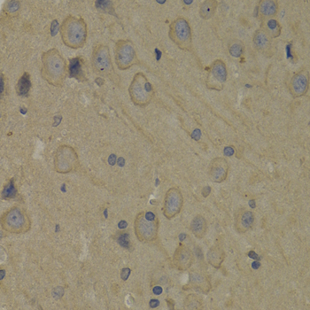 Anti-PI3 Kinase p85 alpha Antibody (CAB0054)