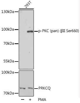 Anti-Phospho-PKC (pan) (beta-II Ser660) Antibody (CABP0495)