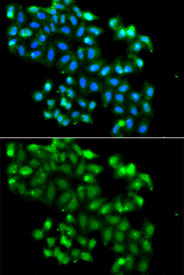 Anti-PHF11 Antibody (CAB7803)