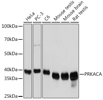 Anti-PRKACA Mouse Monoclonal Antibody (CAB18603)
