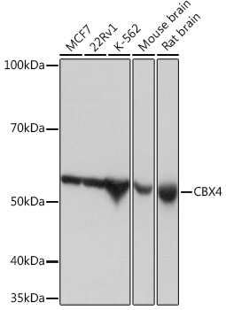 Anti-CBX4 Antibody (CAB5109)