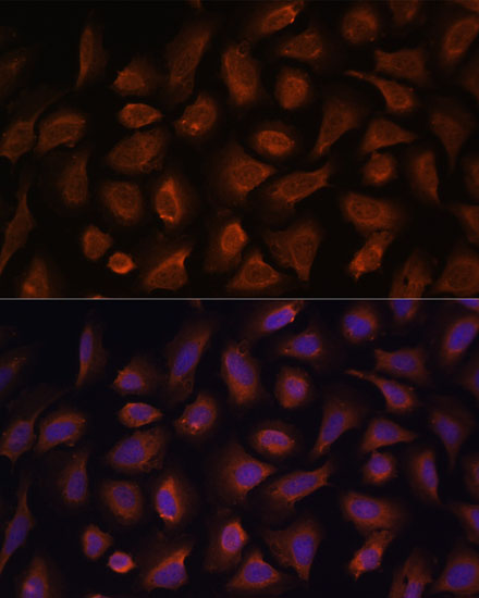 Anti-TSLP Antibody (CAB13134)