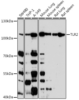 Anti-TLR2 Antibody (CAB11225)
