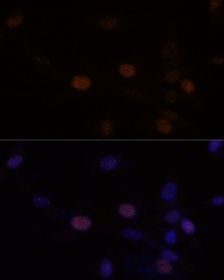 Anti-citrulline-Histone H3-R2/R8/R17 Antibody (CAB18298)