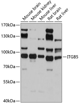 Anti-ITGB5 Antibody (CAB2497)