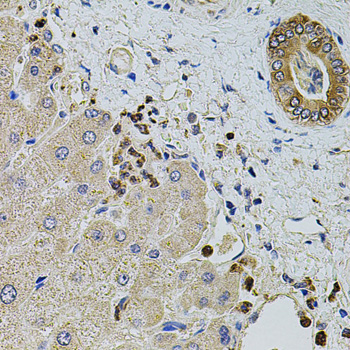 Anti-KTN1 Antibody (CAB5879)