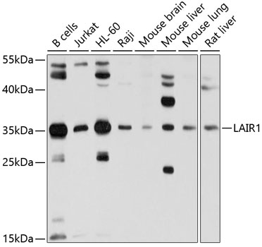 Anti-LAIR1 Antibody (CAB10120)