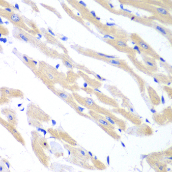 Anti-TRIM21 Antibody (CAB13547)