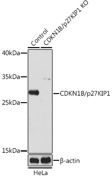 Anti-CDKN1B/p27KIP1 Antibody [KO Validated] (CAB0290)