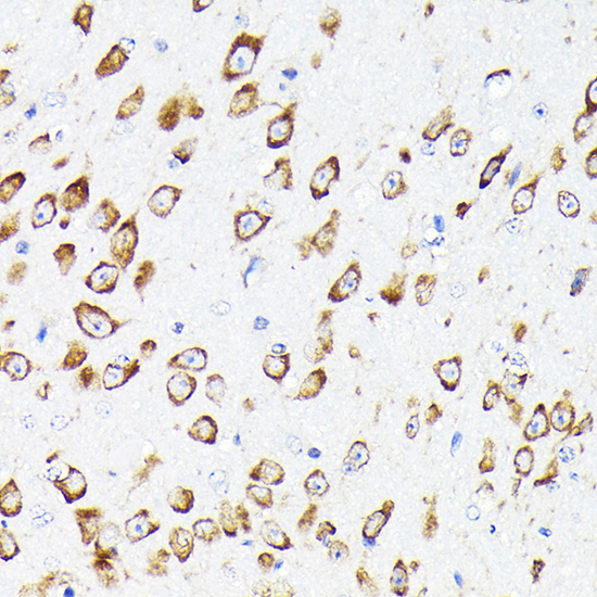 Anti-EEF1G Antibody (CAB7891)