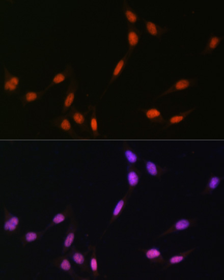 Anti-MonoMethyl-Histone H4-K5 Antibody (CAB17859)