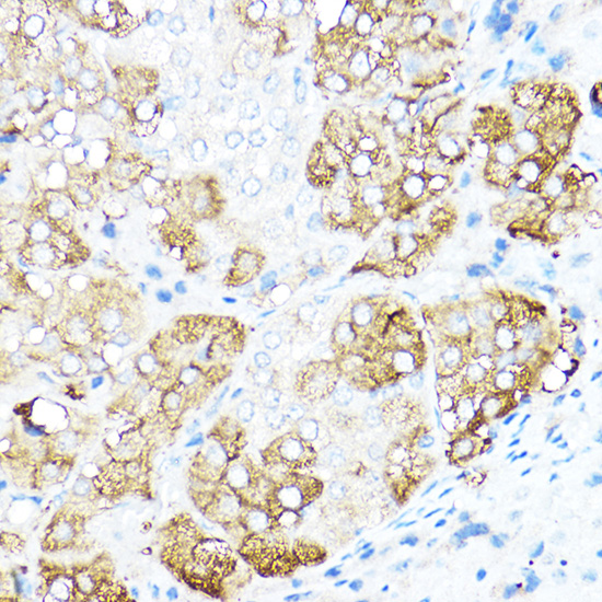 Anti-TH Antibody (CAB12756)