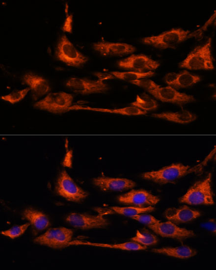 Anti-ACOX3 Antibody (CAB17020)