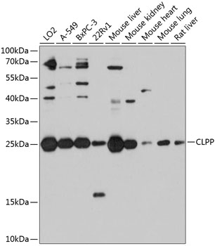 Anti-CLPP Polyclonal Antibody (CAB9127)