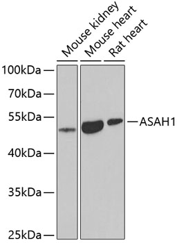 Anti-ASAH1 Antibody (CAB6527)