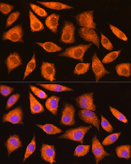 Anti-MDM2 Antibody (CAB13327)