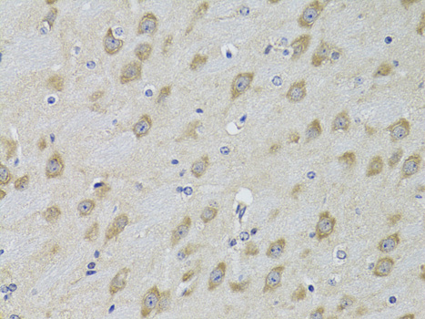 Anti-ADRBK2 Antibody (CAB2049)