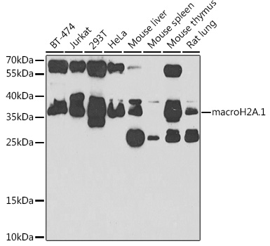 Anti-macroH2A.1 Antibody [KO Validated] (CAB7045)