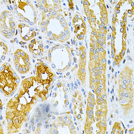 Anti-TNFRSF11B Antibody (CAB2100)