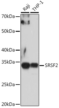 Anti-SRSF2 Antibody (CAB3635)