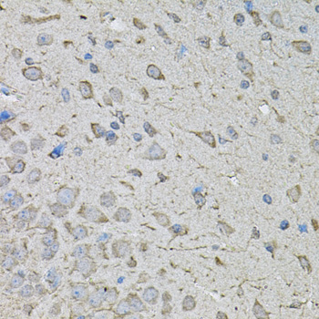 Anti-CDK10 Antibody (CAB2690)