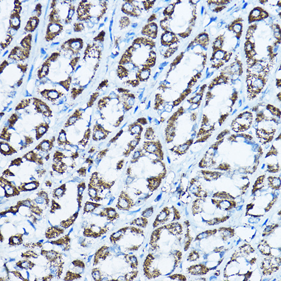 Anti-ATP5O Polyclonal Antibody (CAB8103)