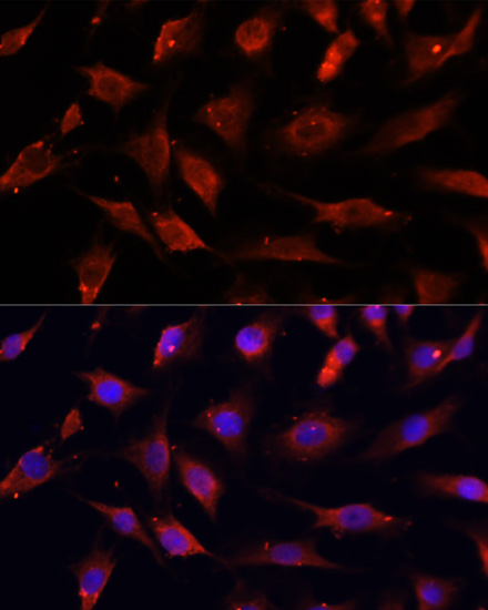 Anti-DNASE1L1 Antibody (CAB13150)