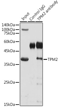Anti-TPM2 Antibody (CAB3096)