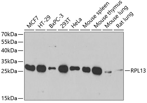 Anti-RPL13 Antibody (CAB4083)