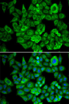 Anti-OGDH Antibody (CAB6391)