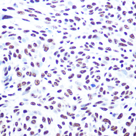 Anti-PRKDC Antibody (CAB1419)