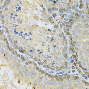 Anti-BUB1 Antibody (CAB1929)