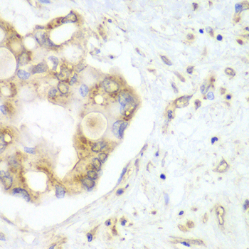 Anti-VTI1B Antibody (CAB7062)