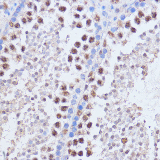 Anti-BRD4 Antibody (CAB2249)