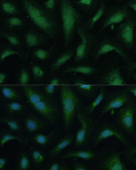 Anti-KIF14 Antibody (CAB10275)