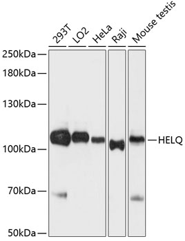 Anti-HEL308 Antibody (CAB12661)