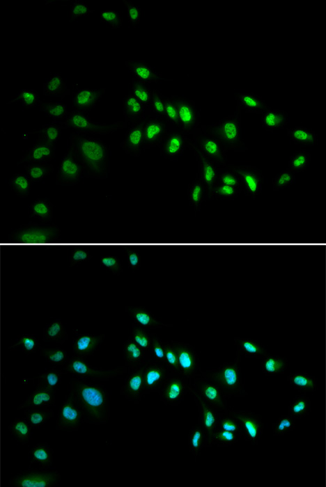 Anti-DNMT3A Antibody (CAB3169)