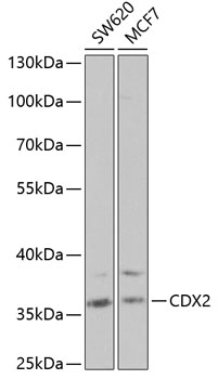 Anti-CDX2 Antibody (CAB1629)