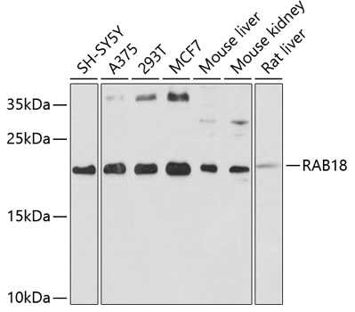 Anti-RAB18 Antibody (CAB2812)