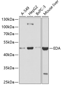 Anti-EDA Antibody (CAB2905)