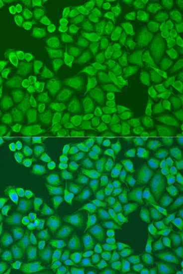 Anti-IFI44 Polyclonal Antibody (CAB8188)