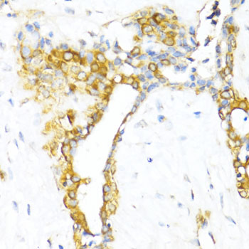 Anti-CTGF Antibody (CAB11067)