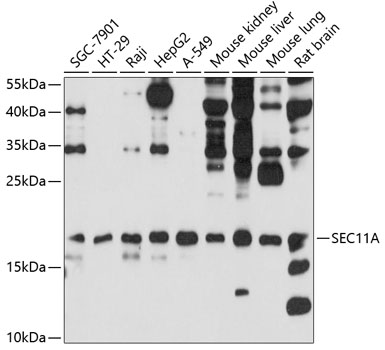 Anti-SEC11A Antibody (CAB10552)