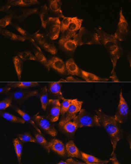 Anti-APRT Antibody (CAB13946)