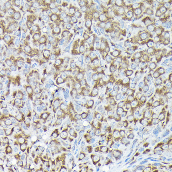 Anti-RPS15A Antibody (CAB10241)