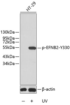 Anti-Phospho-Ephrin-B2-Y330 Antibody (CABP0339)