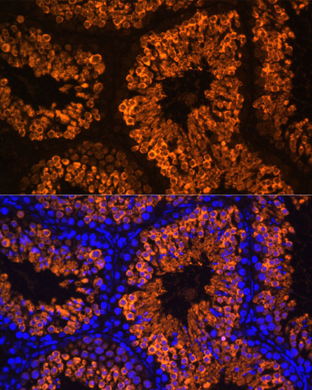 Anti-LDHC Antibody (CAB15003)