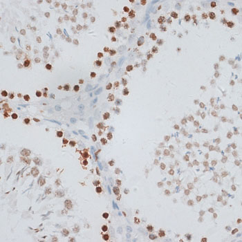 Anti-Histone H2AX Antibody (CAB11540)