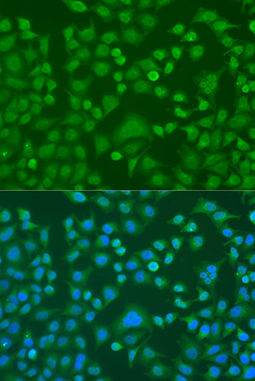 Anti-EWSR1 Antibody (CAB1690)